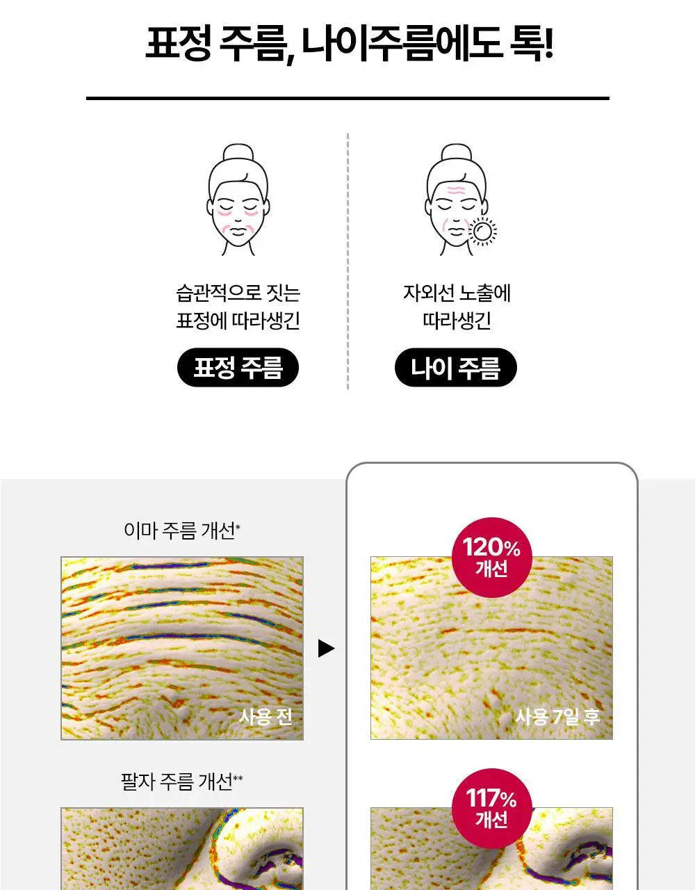 [윤곽앰플] 메디톡스 뉴라덤 코어타임 앰플 15ml [기획(+7ml)/단품] 상세페이지 27